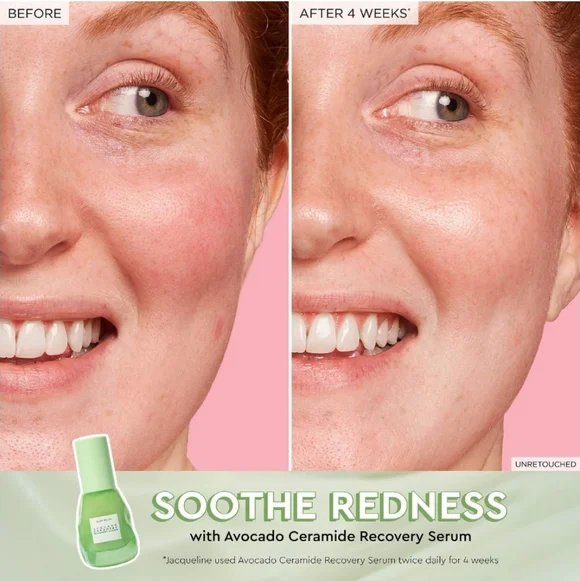 Glow Recipe Avocado Ceramide Recovery Serum, 30ml, NIB - Picture 3 of 7